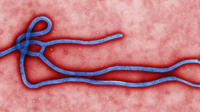 Virion du virus Ebola observé au microscope électronique