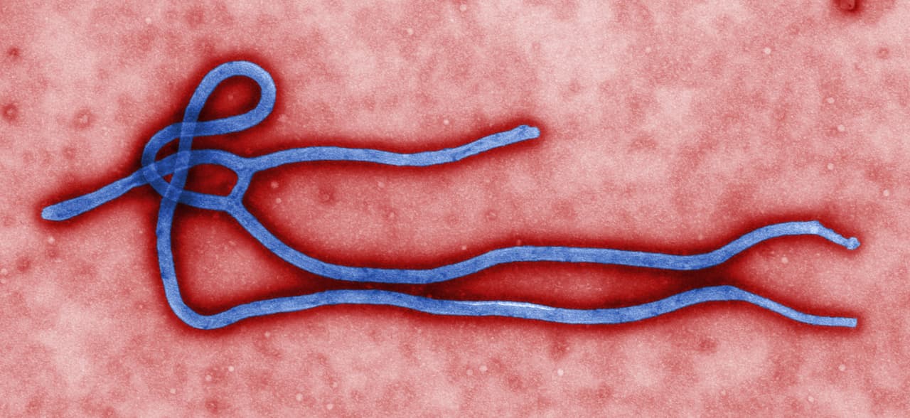 Virion du virus Ebola observé au microscope électronique