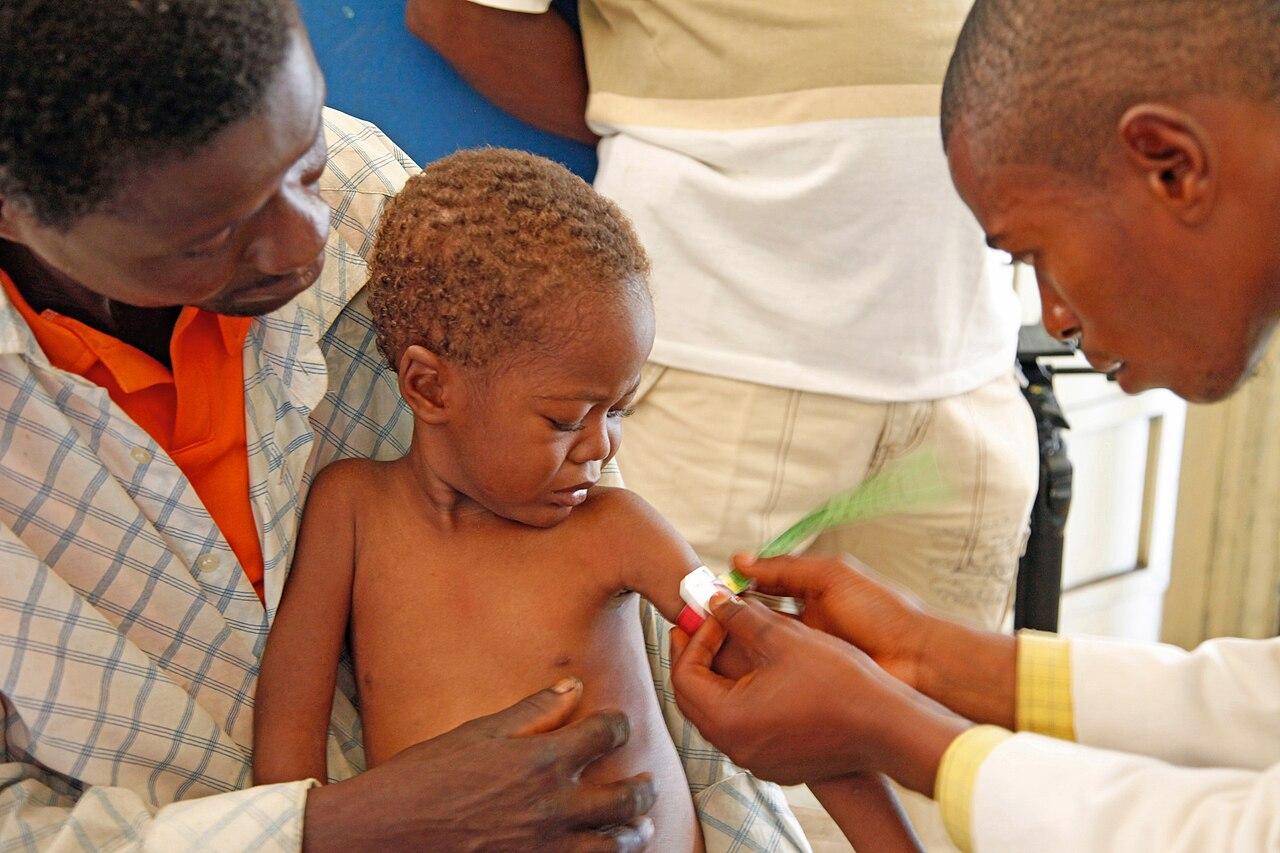 La faim aiguë touche 266 millions de personnes dans le monde, la RDC parmi les plus affectées